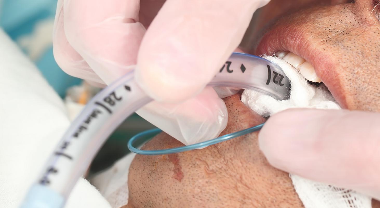 Actualización en los Cuidados Avanzados de los Trastornos Cardiocirculatorios y Respiratorios en la UCI
