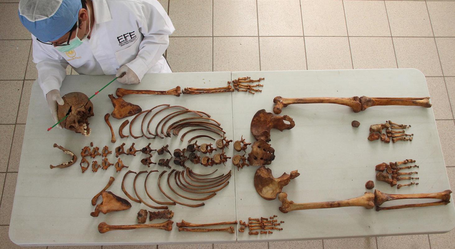 Antropología Forense para Enfermería