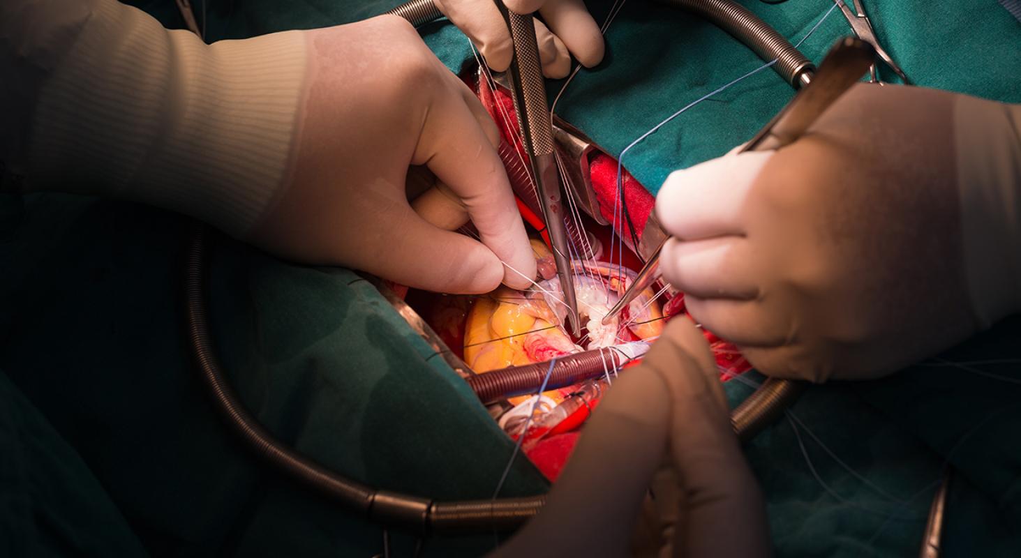 Cirugía Cardiaca para Enfermería