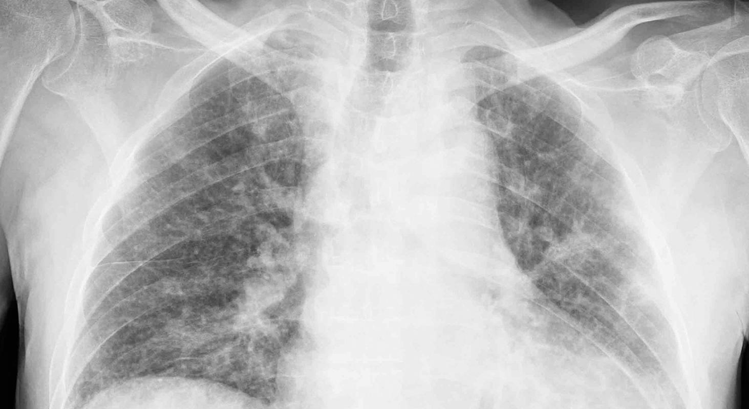 Enfermedades Infecciosas en el Servicio de Urgencias