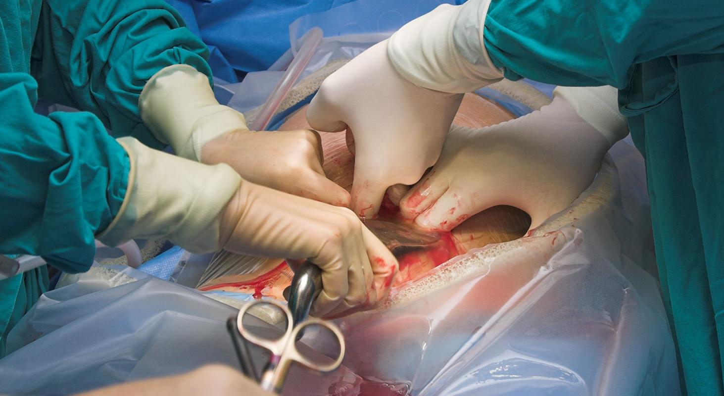 Enfermería en Quirófano y Cuidados Intraoperatorios