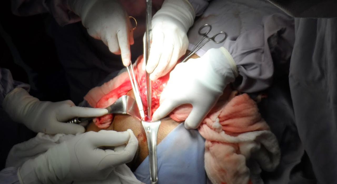 terapia fotodinámica para el cáncer de próstata localizado terapia fotodinámica para el cáncer de próstata localizado