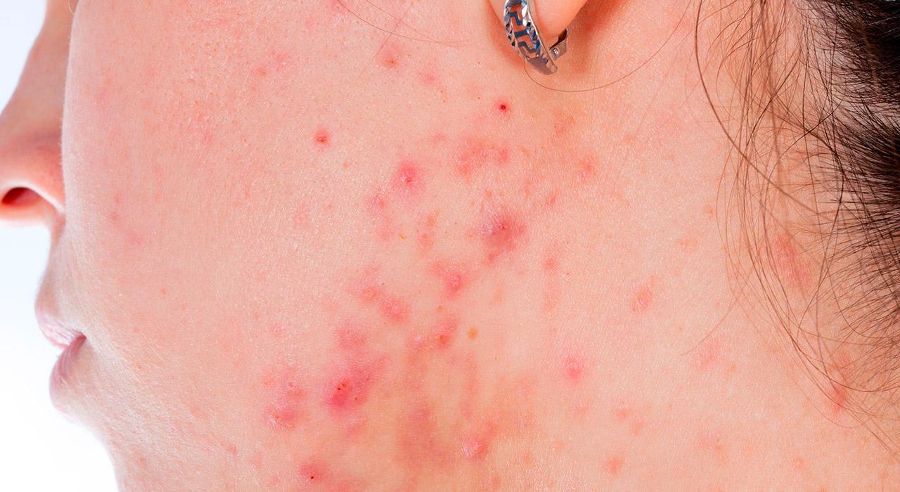 imagenes de enfermedades infecciosas y no infecciosas