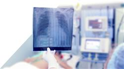 curso profesional curso profesional imagen clinica patologia parato respiratorio urgencias cuidados criticos Tech Universidad