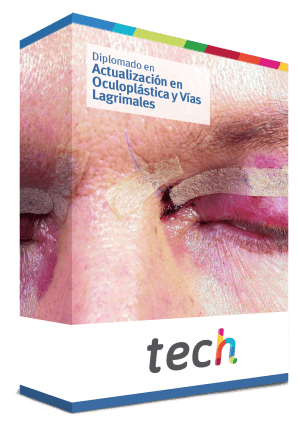diplomado actualizacion oculoplastica vias lagrimales caja