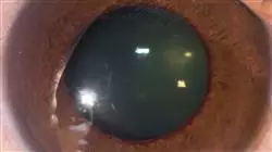 ##IMAGE##