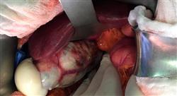 especializacion tumores infrecuentes digestivos ginecológicos y hereditarios