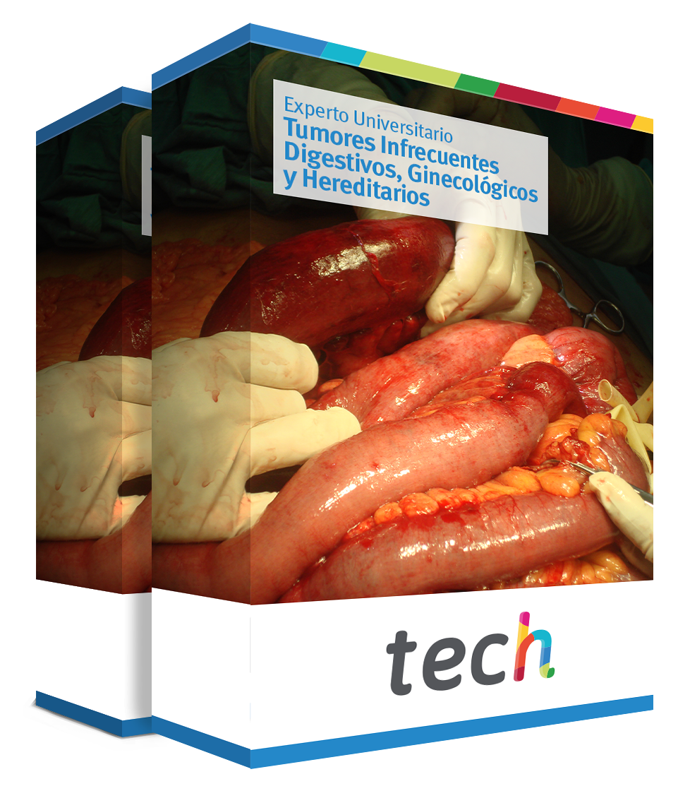 especializacion tumores infrecuentes digestivos ginecologicos hereditarios caja