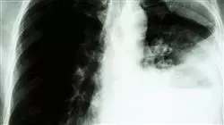 ##IMAGE##