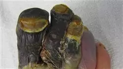 ##IMAGE##