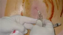 ##IMAGE##