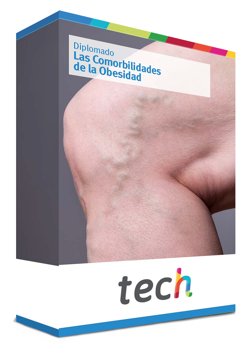 diplomado comorbilidades obesidad caja