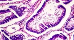 curso online tumores digestivos infrecuentes tumores neuroendocrinos digestivos cáncer de tiroides
