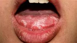 ##IMAGE##