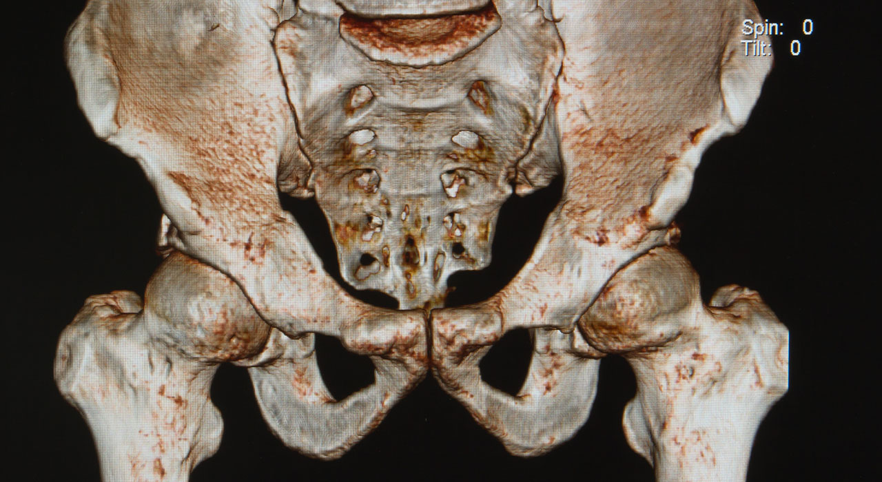 Фото костей таза человека с описанием и суставов скелет