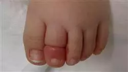 ##IMAGE##
