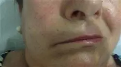 ##IMAGE##