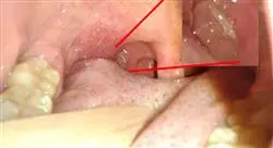 especializacion cavidad oral faringe y voz