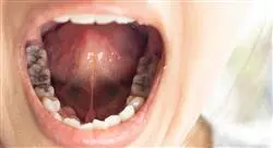 experto cavidad oral faringe y voz
