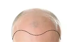 ##IMAGE##