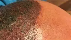 ##IMAGE##