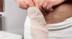 especializacion online Ostomías Digestivas de Alimentación, Intestinales y Urinarias para Enfermería