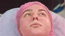##IMAGE##