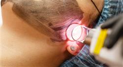 master medicina estética y tratamiento del acné