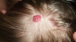 maestria online dermatologia pediatrica