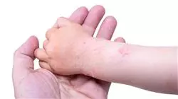 master online dermatologia pediatrica