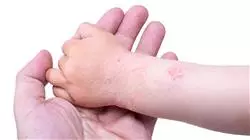 ##IMAGE##