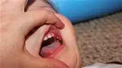 ##IMAGE##