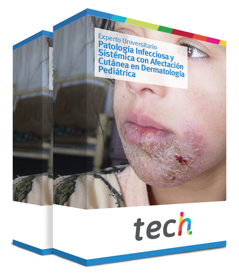 especializacion patologia infecciosa sistemica afectacion cutanea dermatologia pediatrica caja