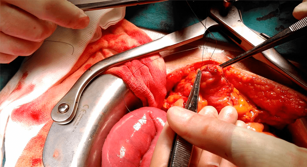 maestria actualización en cirugía general y del aparato digestivo