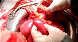 master actualización en cirugía general y del aparato digestivo