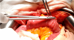 posgrado actualización en cirugía general y del aparato digestivo