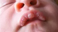 ##IMAGE##