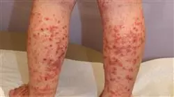 ##IMAGE##