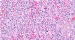 especializacion online dermatología vascular pediátrica