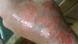 ##IMAGE##