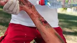 ##IMAGE##