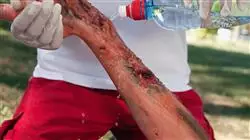 ##IMAGE##