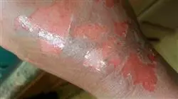 ##IMAGE##