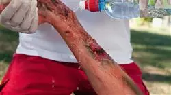 ##IMAGE##