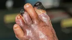 ##IMAGE##