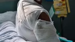 ##IMAGE##