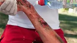 ##IMAGE##