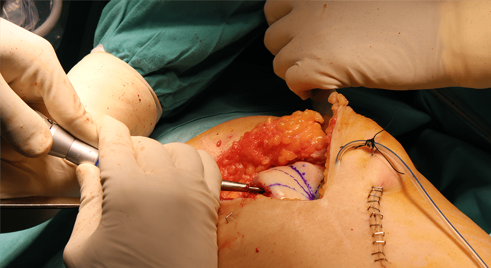 master online actualización en cirugía ortopédica y traumatología