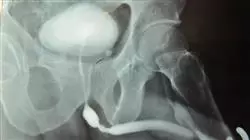 ##IMAGE##