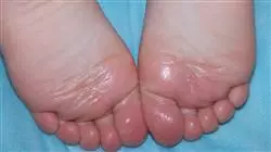 ##IMAGE##